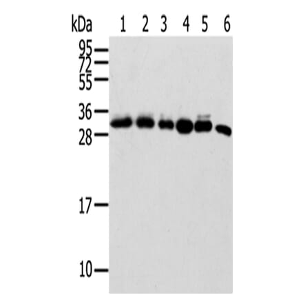 SENP8 Antibody from Signalway Antibody (42748) - Antibodies.com
