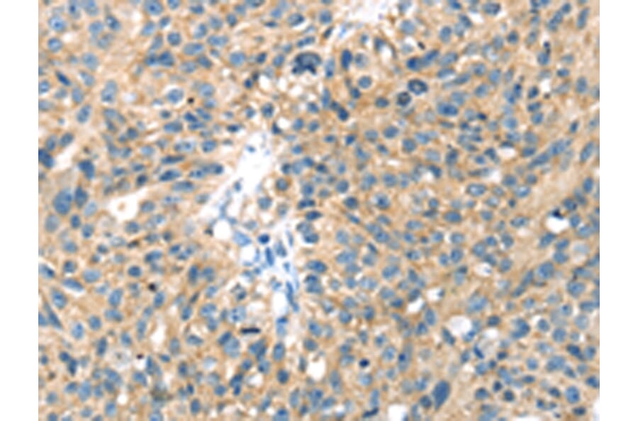 Immunohistochemistry - SENP8 Antibody from Signalway Antibody (42748) - Antibodies.com