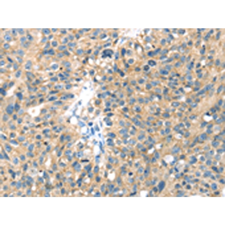 Immunohistochemistry - SENP8 Antibody from Signalway Antibody (42748) - Antibodies.com