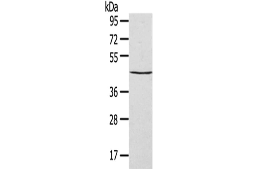 SEPT2 Antibody from Signalway Antibody (42751) - Antibodies.com