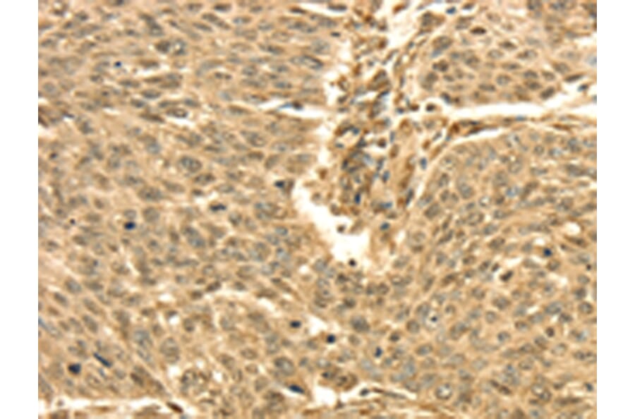 Immunohistochemistry - SEPT2 Antibody from Signalway Antibody (42751) - Antibodies.com