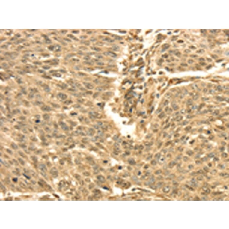 Immunohistochemistry - SEPT2 Antibody from Signalway Antibody (42751) - Antibodies.com