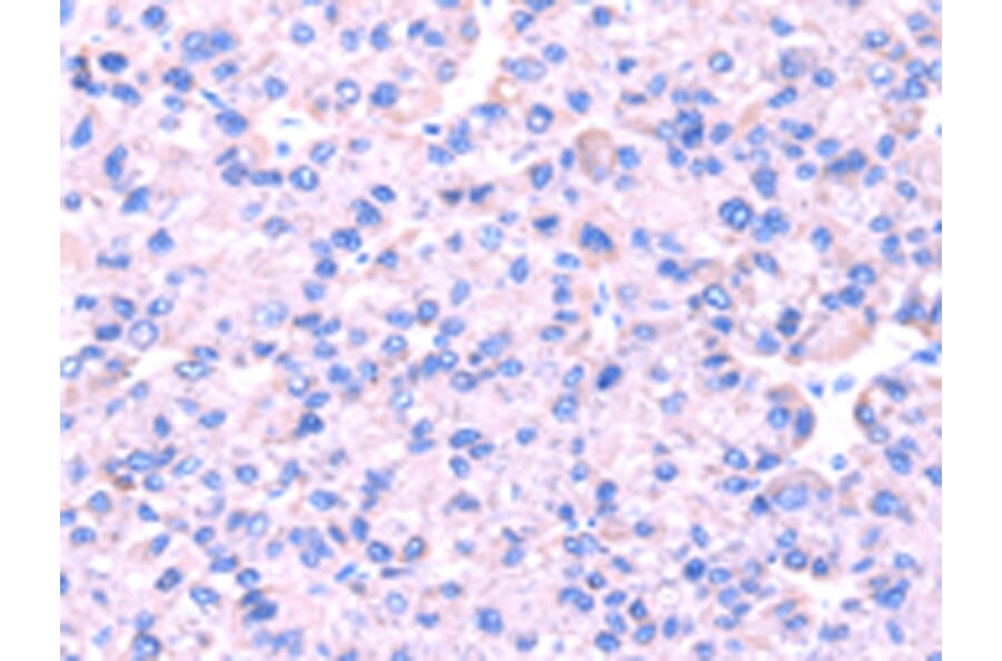 Immunohistochemistry - SRPK1 Antibody from Signalway Antibody (42755) - Antibodies.com