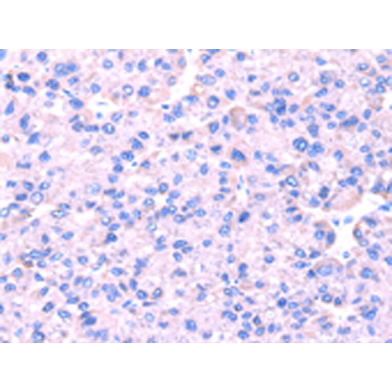 Immunohistochemistry - SRPK1 Antibody from Signalway Antibody (42755) - Antibodies.com