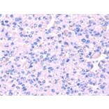 Immunohistochemistry - SRPK1 Antibody from Signalway Antibody (42755) - Antibodies.com