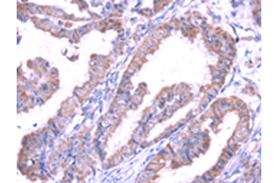 Immunohistochemistry - SRPK1 Antibody from Signalway Antibody (42755) - Antibodies.com