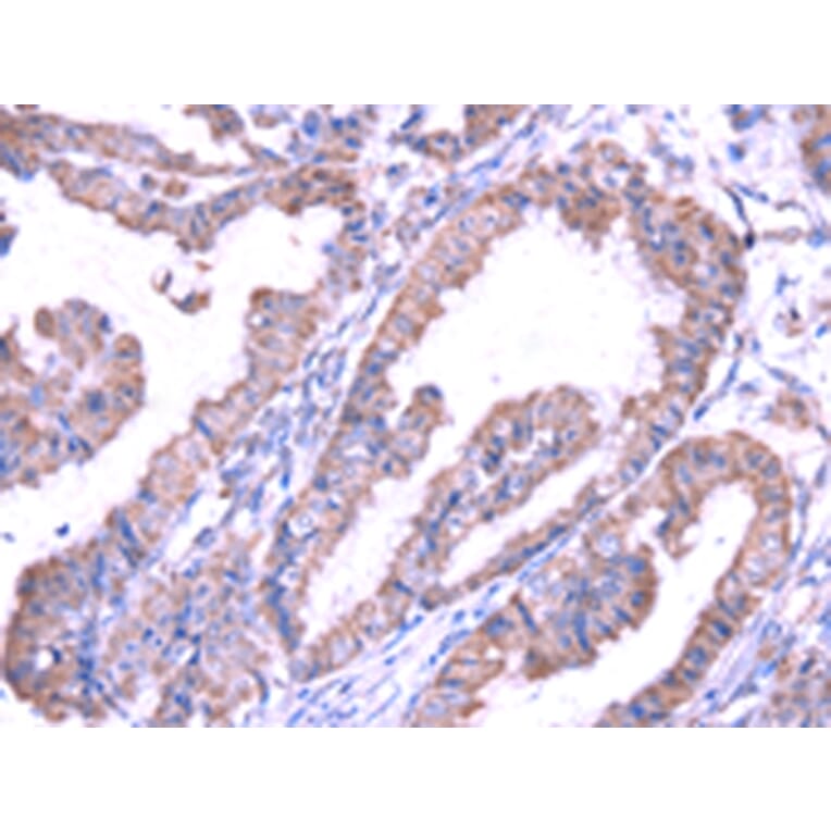 Immunohistochemistry - SRPK1 Antibody from Signalway Antibody (42755) - Antibodies.com