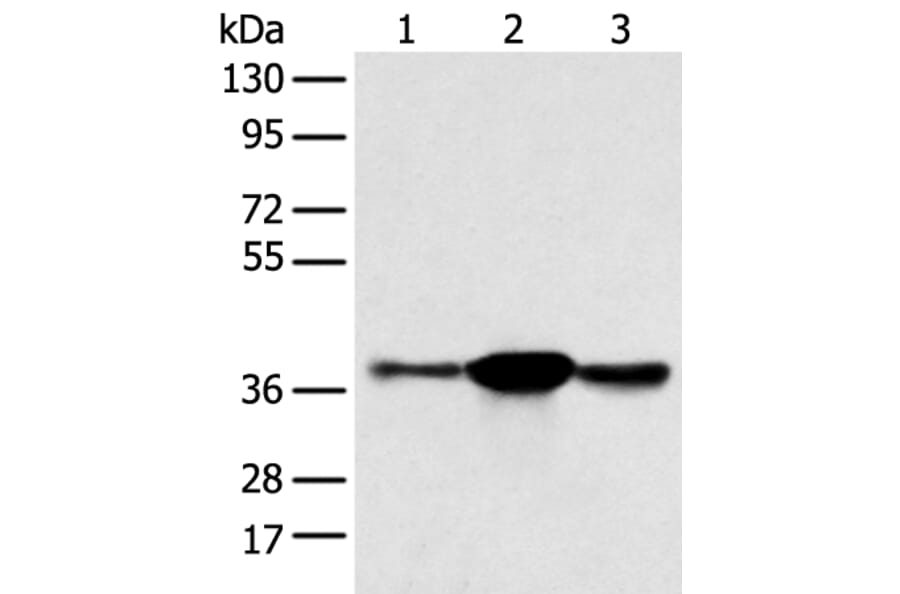 SPRY4 Antibody from Signalway Antibody (42766) - Antibodies.com
