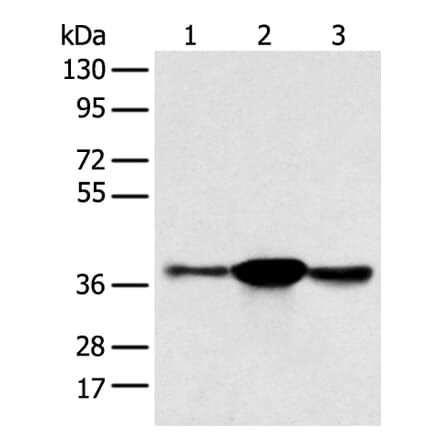 SPRY4 Antibody from Signalway Antibody (42766) - Antibodies.com