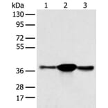 SPRY4 Antibody from Signalway Antibody (42766) - Antibodies.com