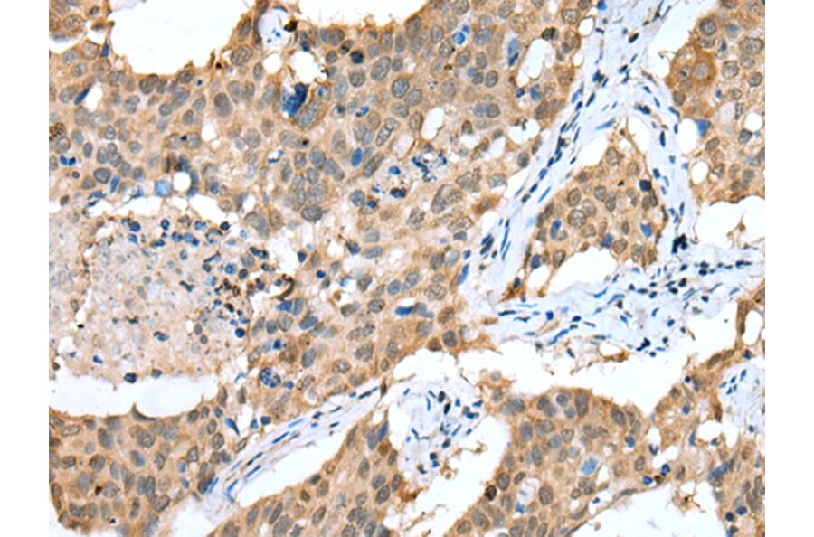 Immunohistochemistry - SPRY4 Antibody from Signalway Antibody (42766) - Antibodies.com