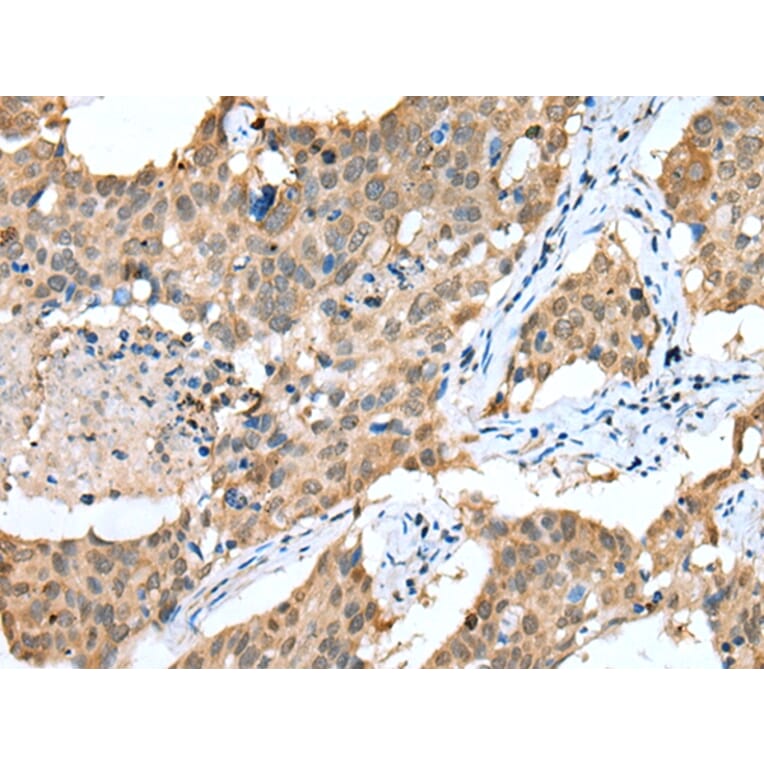 Immunohistochemistry - SPRY4 Antibody from Signalway Antibody (42766) - Antibodies.com