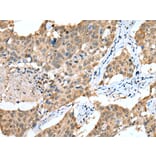 Immunohistochemistry - SPRY4 Antibody from Signalway Antibody (42766) - Antibodies.com
