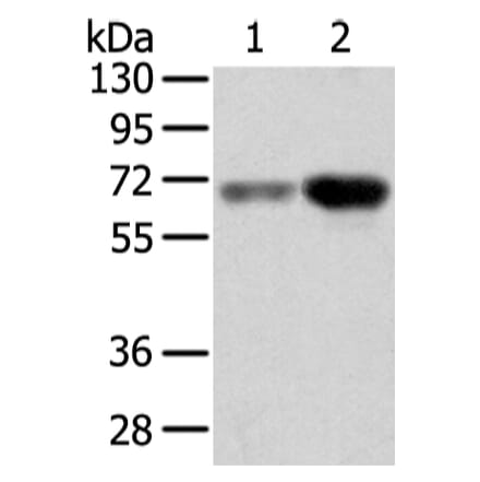 TBL1X Antibody from Signalway Antibody (42774) - Antibodies.com