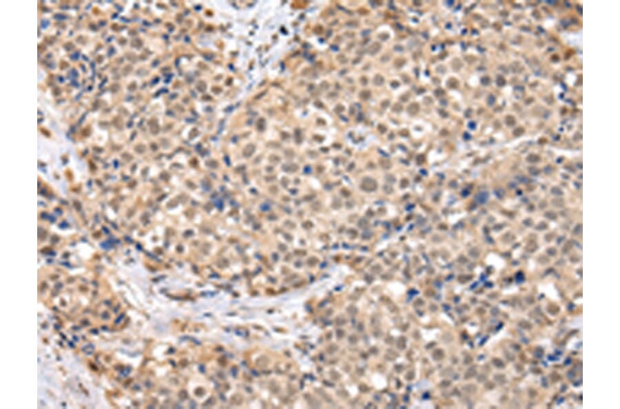 Immunohistochemistry - TBL1X Antibody from Signalway Antibody (42774) - Antibodies.com