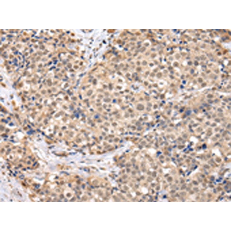 Immunohistochemistry - TBL1X Antibody from Signalway Antibody (42774) - Antibodies.com