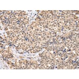 Immunohistochemistry - TBL1X Antibody from Signalway Antibody (42774) - Antibodies.com