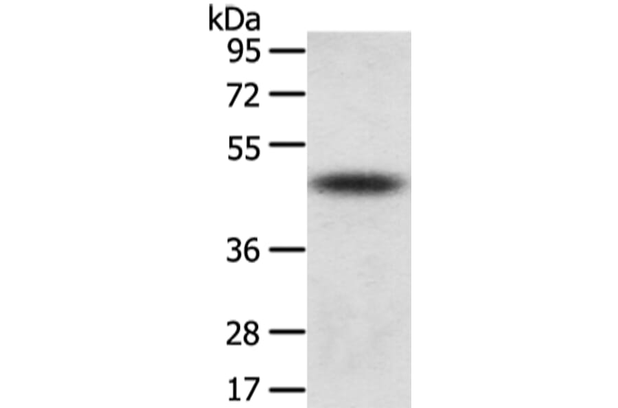 TTC23 Antibody from Signalway Antibody (42795) - Antibodies.com