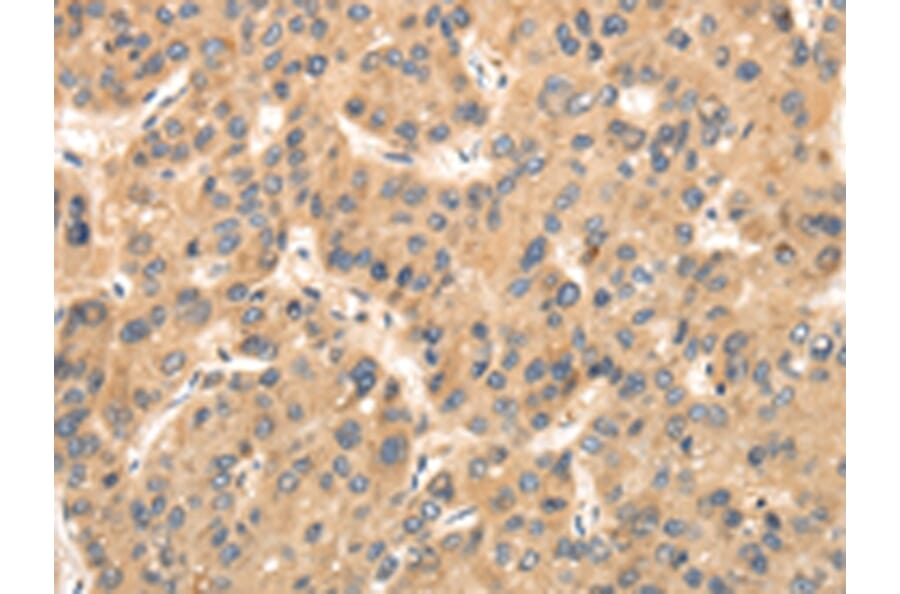 Immunohistochemistry - TTC23 Antibody from Signalway Antibody (42795) - Antibodies.com