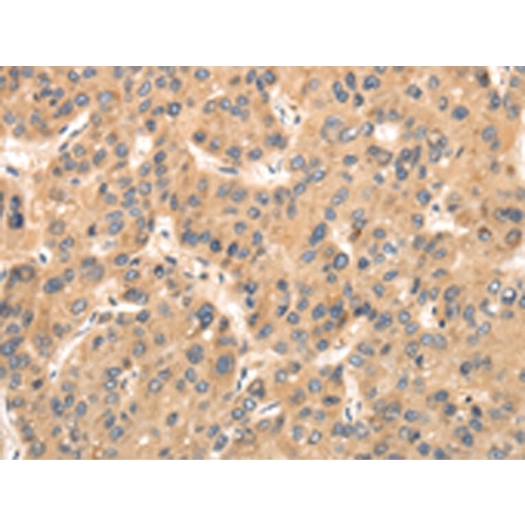 Immunohistochemistry - TTC23 Antibody from Signalway Antibody (42795) - Antibodies.com