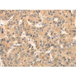 Immunohistochemistry - TTC23 Antibody from Signalway Antibody (42795) - Antibodies.com