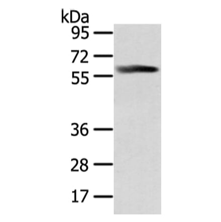 PPP5C Antibody from Signalway Antibody (42806) - Antibodies.com