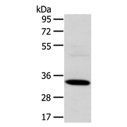 SDCBP Antibody from Signalway Antibody (42808) - Antibodies.com