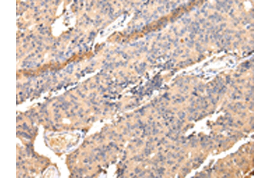 Immunohistochemistry - SDCBP Antibody from Signalway Antibody (42808) - Antibodies.com
