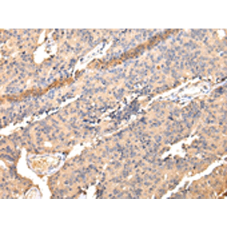 Immunohistochemistry - SDCBP Antibody from Signalway Antibody (42808) - Antibodies.com