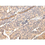 Immunohistochemistry - SDCBP Antibody from Signalway Antibody (42808) - Antibodies.com