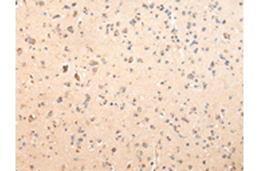 Immunohistochemistry - SDCBP Antibody from Signalway Antibody (42808) - Antibodies.com