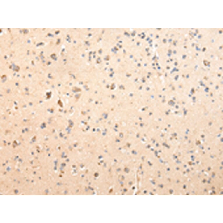Immunohistochemistry - SDCBP Antibody from Signalway Antibody (42808) - Antibodies.com