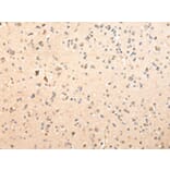 Immunohistochemistry - SDCBP Antibody from Signalway Antibody (42808) - Antibodies.com