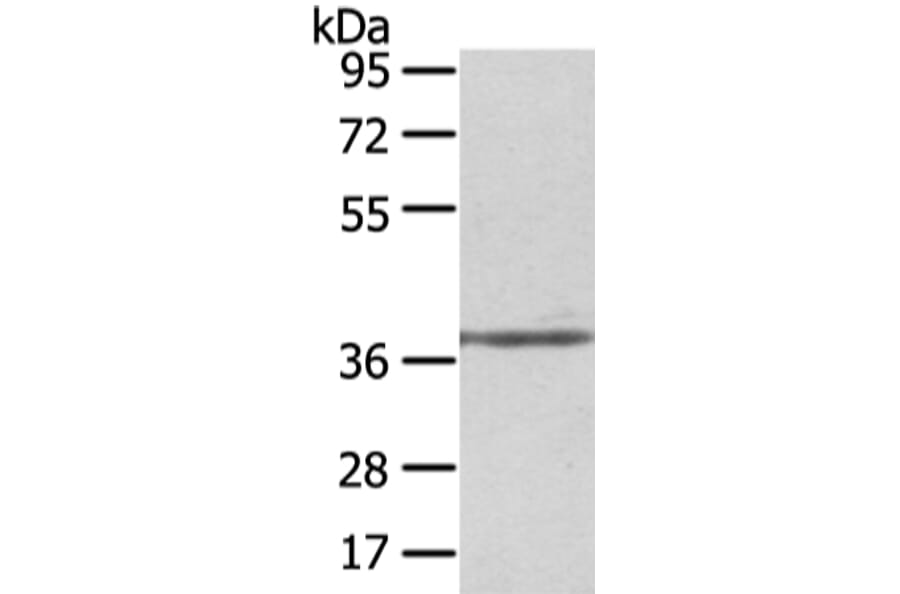 STRAP Antibody from Signalway Antibody (42813) - Antibodies.com