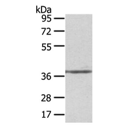 STRAP Antibody from Signalway Antibody (42813) - Antibodies.com