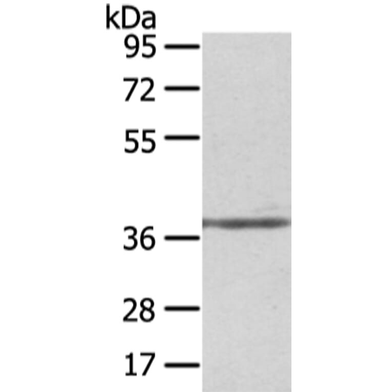 STRAP Antibody from Signalway Antibody (42813) - Antibodies.com