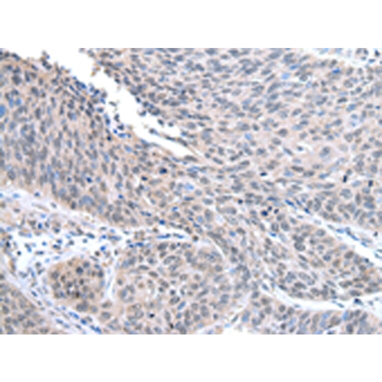 Immunohistochemistry - STRAP Antibody from Signalway Antibody (42813) - Antibodies.com
