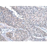 Immunohistochemistry - STRAP Antibody from Signalway Antibody (42813) - Antibodies.com