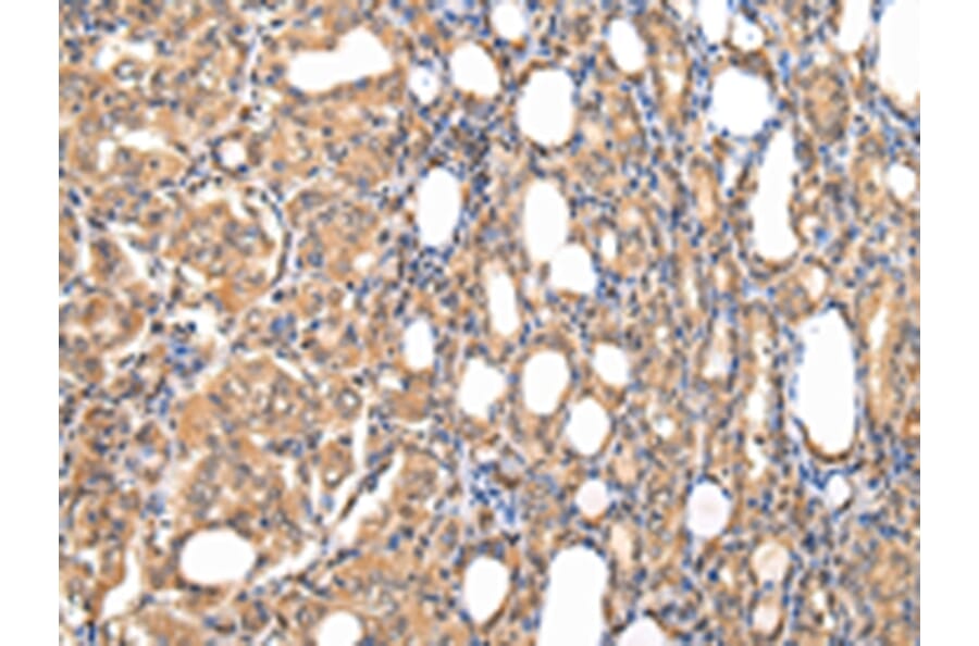 Immunohistochemistry - STRAP Antibody from Signalway Antibody (42813) - Antibodies.com