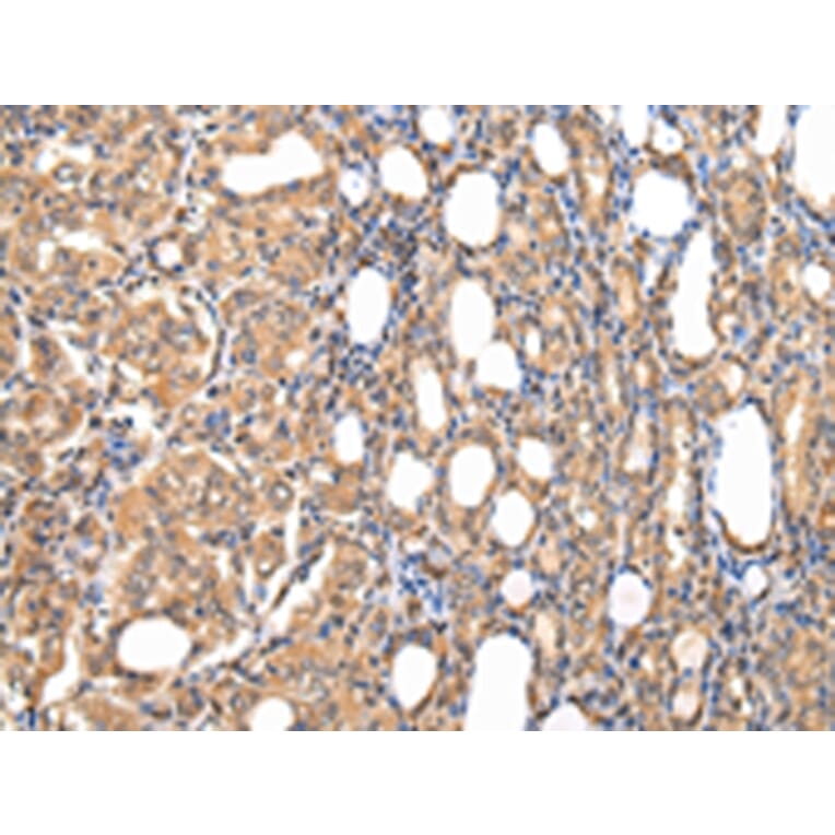 Immunohistochemistry - STRAP Antibody from Signalway Antibody (42813) - Antibodies.com