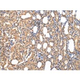 Immunohistochemistry - STRAP Antibody from Signalway Antibody (42813) - Antibodies.com