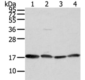 VAMP4 Antibody from Signalway Antibody (42824) - Antibodies.com