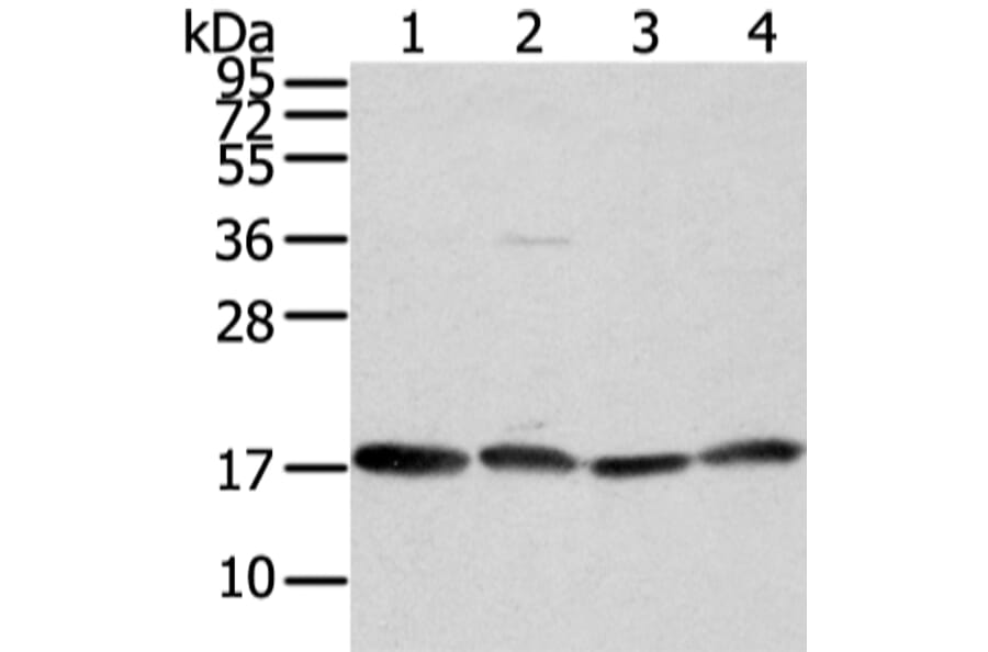 VAMP4 Antibody from Signalway Antibody (42824) - Antibodies.com