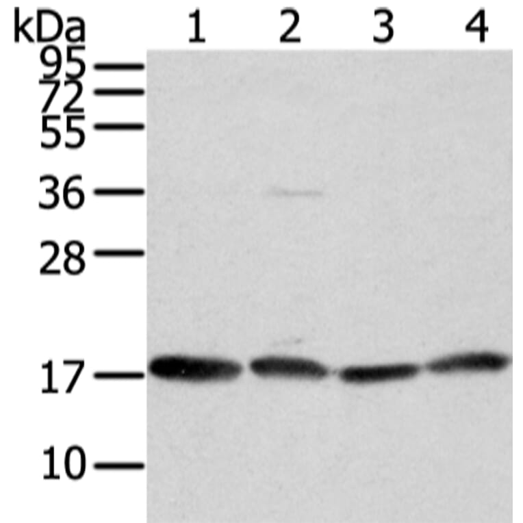 VAMP4 Antibody from Signalway Antibody (42824) - Antibodies.com