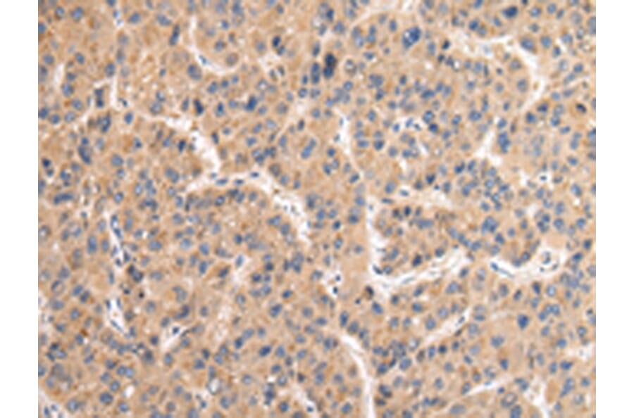 Immunohistochemistry - VAMP4 Antibody from Signalway Antibody (42824) - Antibodies.com