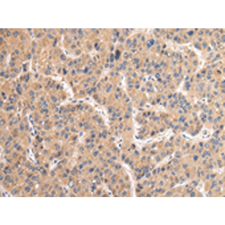 Immunohistochemistry - VAMP4 Antibody from Signalway Antibody (42824) - Antibodies.com
