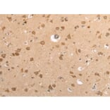 Immunohistochemistry - VAMP4 Antibody from Signalway Antibody (42824) - Antibodies.com