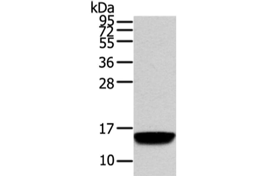 VAMP5 Antibody from Signalway Antibody (42825) - Antibodies.com