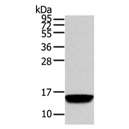 VAMP5 Antibody from Signalway Antibody (42825) - Antibodies.com