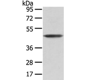 VASH1 Antibody from Signalway Antibody (42827) - Antibodies.com